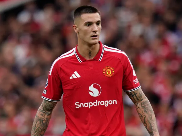 Man United release Sesko statement as fears over shin issue grow