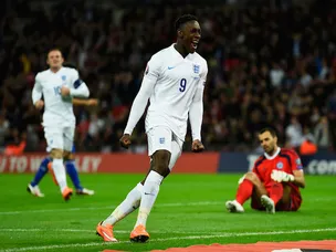 Hodgson plays down Welbeck injury