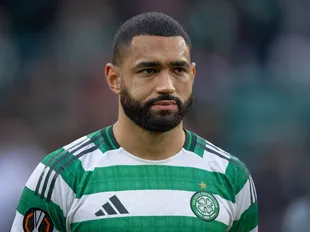 Celtic games Carter-Vickers will miss after major injury blow confirmed