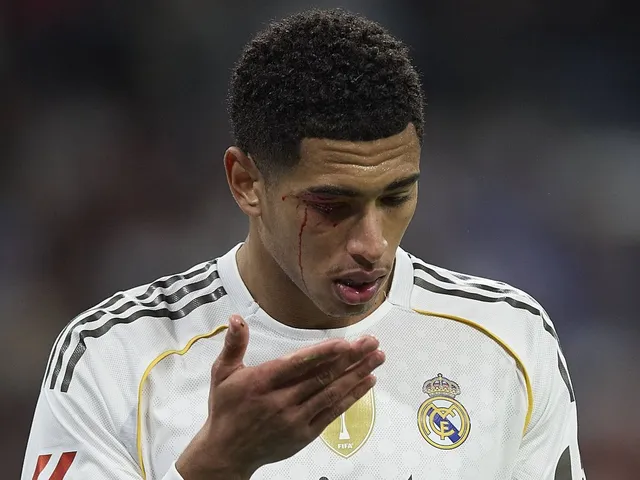 Bellingham injury latest as Alonso faces pressure after La Liga collapse