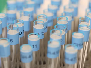 WADA reveals "serious failings" at Rio 2016
