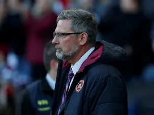 Levein "excited" to focus on cup following derby loss